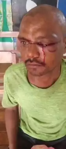 कांकेर: कोमलपुर ढाबा में मजदूरी का पैसा मांगने पर मालिक ने मिस्त्री की की पिटाई, मामला दर्ज