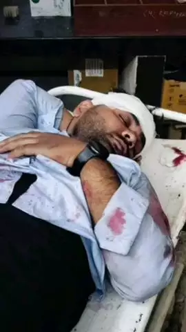 बस्सी: कालाडेरा इलाके में बीती रात दो मोटरसाइकिलों की आमने-सामने भिड़ंत, एक युवक की दर्दनाक मौत, दूसरा गंभीर घायल