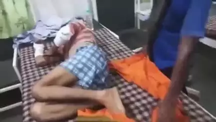 भांडेर: बैजापारा में पालतू सुअर ने युवक पर किया हमला, काटा, लहूलुहान किया, गंभीर हालत में अस्पताल रेफर