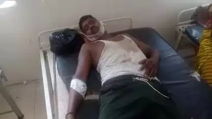 सिहावल: सीधी जिले के पड़रिया में पुराने विवाद में मारपीट, एक व्यक्ति घायल