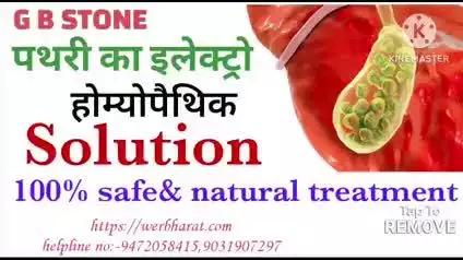 **"Pathri Ka Electro Homeopathic Solution | 100% Safe & Natural Treatment"**
Contact no.94720 58415, 94 314 61 398,