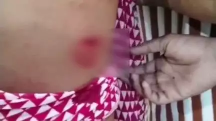 गिर्वा: फारूख आजम कॉलोनी में आपसी रंजिश के चलते हुई चाकूबाजी, दो युवक हुए घायल