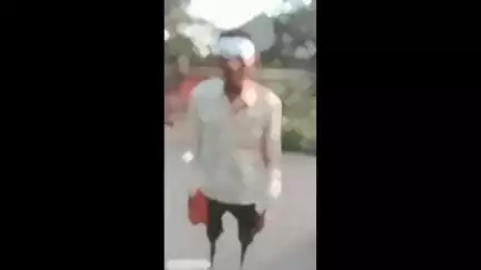 अमेठी: संग्रामपुर कोतवाली क्षेत्र में भारी महुआ की डाल गिरने से अधेड़ गंभीर रूप से घायल
