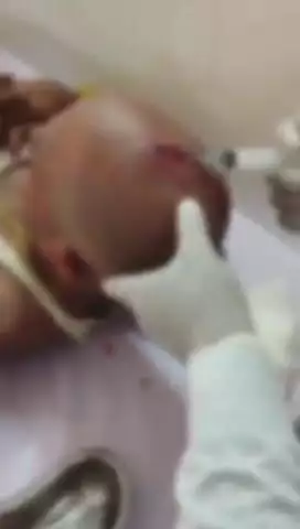 डुमरांव: कंझरूआ गांव में खूनी संघर्ष मामले में दो गिरफ्तार, पुलिस अभिरक्षा में चल रहा घायलों का इलाज