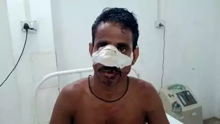 अमरपुर: नरकट्टा गांव: चम्मच के लिए बच्चों के झगड़े में बड़े भाई ने छोटे पर किया जानलेवा हमला