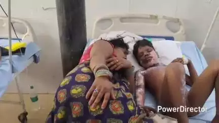 मऊ: चित्रकूट जनपद के रामनगर में तालाब से भसींड़ तोड़ते समय करंट की चपेट में आने से मां-बेटे झुलसे, जिला अस्पताल रेफर