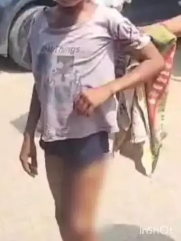 तिजारा: सैदपुर गांव में एक 12 वर्षीय बच्चे को कुत्ते ने काटा, जिला अस्पताल में कराया गया भर्ती