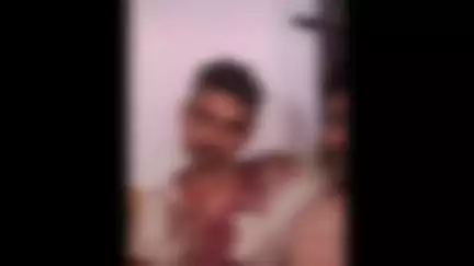 बड़ौत: कोताना गांव में 2 पक्षों के बीच मामूली विवाद में लाठी-डंडे व धारदार हथियार चले, 2 लोग घायल
