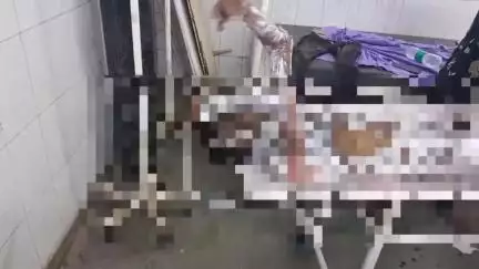 डूंगरपुर: चाैरासी थाना क्षेत्र के पाड़ली सांसरपुर कंजारिया फला गांव में बाइक सवार युवक का आधा शरीर अज्ञात कारणों से जल गया