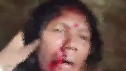 घाट कुसुंभा: महम्मदपुर गांव: छज्जा निकालने के विरोध में मारपीट, 4 पर केस, मां-बेटा घायल