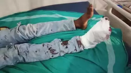 जशपुर: लोरो घाट में कार ने बाइक को मारी टक्कर, दंपती घायल, जिला अस्पताल जशपुर में भर्ती
