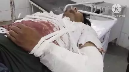 आगर: उज्जैन मार्ग पर पालखेड़ी के पास 20 वर्षीय बाइक चालक डिवाइडर से टकराकर घायल, आगर जिला अस्पताल में भर्ती