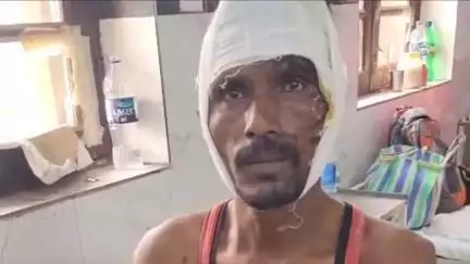 सिवनी: नगझर बायपास के समीप सड़क हादसे में बाइक सवार व्यक्ति हुआ घायल, जांच में जुटी पुलिस