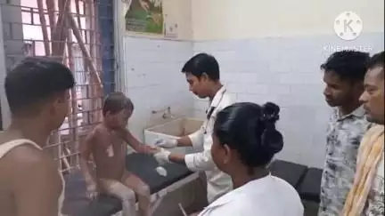 साहिबगंज: लालबथानी सरपंच टोला में हाइटेंशन तार की चपेट में आने से बालक झुलसा, अस्पताल में भर्ती