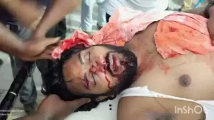 राजमहल: फुलवरिया के पास एक व्यक्ति से मारपीट, गंभीर रूप से हुआ घायल, पुलिस जांच में जुटी