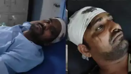मथुरा: नौहझील के गांव जाफरपुर में 2 भाइयों के तेजाब मामले में आया नया मोड़, दोनों पक्ष घायल, अस्पताल में भर्ती कराई पुलिस ने