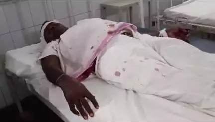 बांसवाड़ा: तलवाड़ा कस्बे में पूर्व के विवाद को लेकर चचेरे भाइयों ने दो भाइयों के साथ की मारपीट, एमजी अस्पताल में उपचार जारी