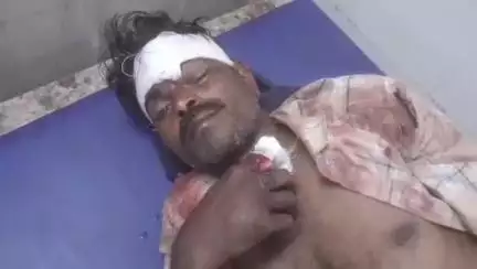 नरसिंहपुर: गंगाई के पास तेज रफ्तार ट्रैक्टर से बाइक की टक्कर, चालक घायल और अस्पताल में भर्ती