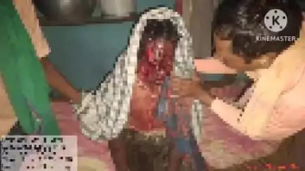 ନୂଆପଡା: ସୋସେଙ୍ଗ ଗ୍ରାମରେ ଭାଲୁ ଆକ୍ରମଣରେ ଦୁଇ ଜଣ ଗୁରୁତର, ଜିଲ୍ଲା ମୁଖ୍ୟ ଚିକିତ୍ସାଳୟରେ ଭର୍ତ୍ତି