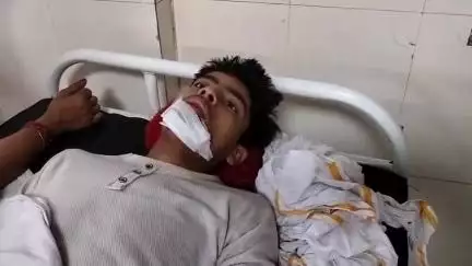 भिंड नगर: नहारा गाँव में दीवार पर पेड़ गिरने से तीन लोग घायल