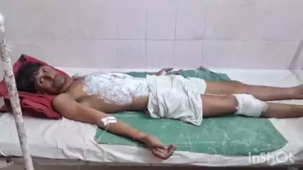 कुलपहाड़: बेला सागर तालाब में आकाशीय बिजली गिरने से चरवाहा झुलस गया, हालत गंभीर