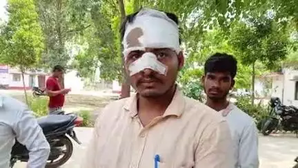 मिल्कीपुर: भाखौली निवासी युवक ने थाना में की शिकायत, शराब के नशे में दो बाइक सवारों ने उसकी बाइक में टक्कर मारकर किया घायल