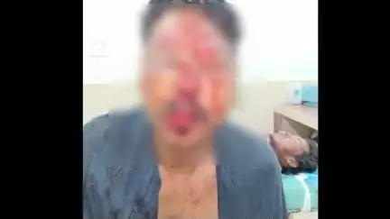 नागपूर शहर: जगदीश नगर मध्ये व्हॅनचालकावर झोपेतच अज्ञात आरोपीने केला जीवघेणा हल्ला