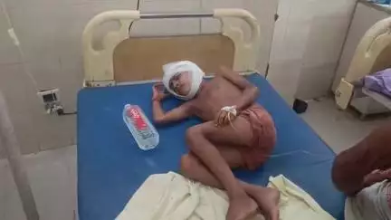 उन्नाव: उन्नाव के सिंघा खेड़ा गांव में छत पर खेलते समय बच्चे का पैर फिसला, गंभीर रूप से घायल होकर जिला अस्पताल में भर्ती
