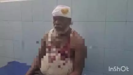 మదనపల్లి టమోటా మార్కెట్ యార్డులో శనివారం రాత్రి హోటల్ ముందు బైకు నిలపవద్దనందంతో కొబ్బరి కాయతో దాడి