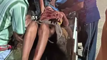 হবিবপুর: কেন্দপুকুর এলাকায় পথ দুর্ঘটনায় গুরুতর আহত এক ব্যক্তি,রেফার মালদা হাসপাতালে