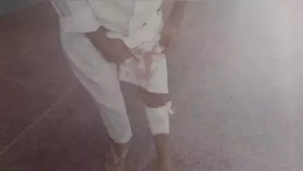 গাজোল: তারা তলা গরু হাঁটি সড়ক এলাকায় মোটর বাইক আরোহীর ধাক্কায় আহত বৃদ্ধ