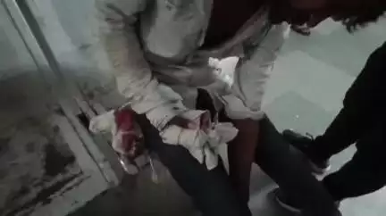 नरसिंहपुर: पुरानी रंजिश में तिंदनी पुल पर बैठे दो दोस्तों पर तीन लोगों ने बका से किया हमला