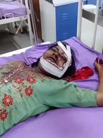 अलवर: ग्राम मीरका बसई में जवाई ने सास, ससुर और पत्नी पर लाठी-कुल्हाड़ी से किया हमला, सास की मौत, 2 घायल