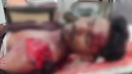 भंडारा: पालगाव येथे अज्ञात वाहनाची  मोटर सायकलला जबर धडक, चालक गंभीर जखमी