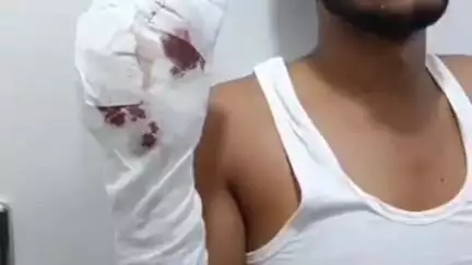 हुज़ूर: सगरा थाना क्षेत्र: कंदैला फिल्टर प्लांट में हादसा, श्रमिक की उंगलियां कटीं, एजेंसी पर लगे आरोप