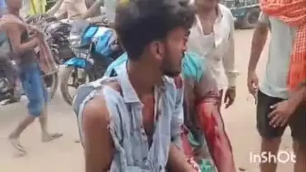 राजपुर: राजपुर बाजार में बस स्टैंड के पास बस पर सवार एक युवक पर चाकू से हमला, युवक बुरी तरह जख्मी