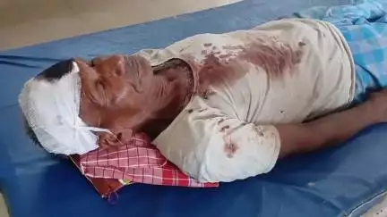 बेतिया: धोबिया टोला में जमीनी विवाद में व्यक्ति पर जानलेवा हमला, हालत नाज़ुक, जीएमसीएच में भर्ती