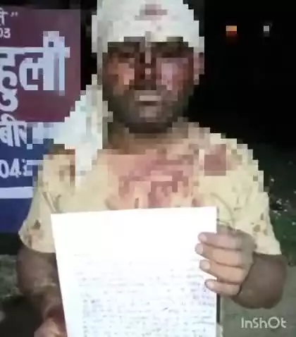 धनघटा: चोलखरी गांव में पुरानी रंजिश के चलते दबंगों ने एक युवक को खेत में मारपीट कर किया घायल