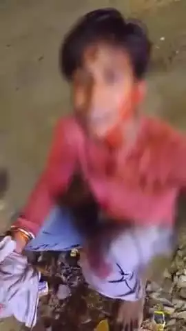 कानपुर: हनुमंत विहार में दबंगों ने युवक को पीट-पीट कर लहूलुहान किया, आई गंभीर चोट