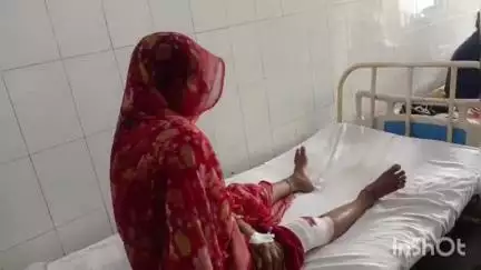 अशोक नगर: बडेरा गांव में महिला पर फायरिंग, आंगन में बैठी महिला के पैर में लगी गोली, तार फेंसिंग के पीछे से हुआ हमला