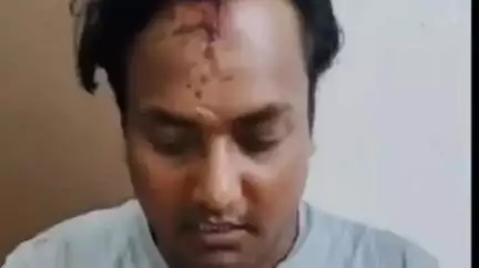 हुज़ूर: देऊ गांव में चोर समझ ग्रामीणों ने MPEB कर्मचारियों पर किया हमला, 4 गंभीर रूप से घायल