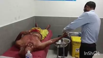 मुंगेर: बिंदवाड़ा में सर पर ईंट लगने से एक व्यक्ति घायल, सदर अस्पताल में इलाज जारी