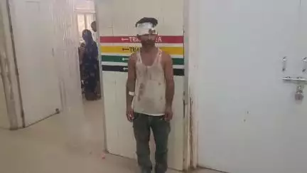 उन्नाव: उन्नाव के थाना बांगरमऊ क्षेत्र के शिव दुलारपुर गांव के बाहर हुई मारपीट में एक व्यक्ति घायल, जिला अस्पताल में भर्ती