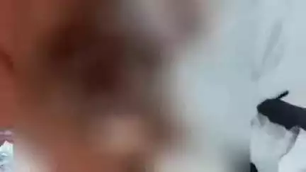 आंवला: आंवला में बिसौली मार्ग पर बोलेरो ने बाइक को मारी टक्कर, बाइक चालक के दोनों पैर टूटे