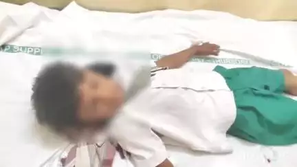 ఆదోని: ఆదోనిలో పాము కాటు గురైన బాలుడికి అస్వస్థత