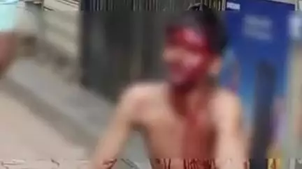 प्रताप चौकात किरकोळ वादातून एकाला बेदम मारहाण, जखमी तरुणाला घाटी रुग्णालयात केले दाखल, व्हिडिओ झाला व्हायरल