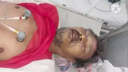 విజయరాయిలో చెట్లు నరికేందుకు కూలీ పనికి వెళ్లి చెట్టు మొద్దు మీద పడి గాలాయగూడెం గ్రామానికి చెందిన వ్యక్తి మృతి