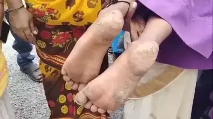 కలెక్టర్ గారు కనికరించండి మా పిల్లల దీనస్థితిని చూడండి : కలెక్టరేట్ ముందు తల్లిదండ్రులు ఆవేదన #localissue