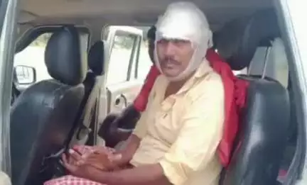सकलडीहा: भलेहटा गांव में बकरी चोरी का विरोध करने पर एक व्यक्ति पर आधा दर्जन बदमाशों ने चाकू से किया हमला, अस्पताल में भर्ती