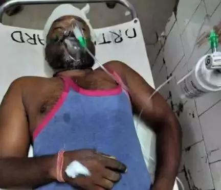 पटमदा: पटमदा के बनकुंचिया में ज़मीन विवाद में दो भाइयों में मारपीट, एक की मौत, दूसरा गंभीर